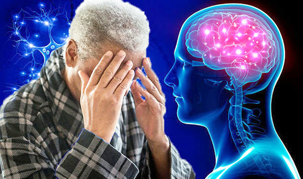 Bệnh Alzheimer: Dấu hiệu nhận biết và cách điều trị