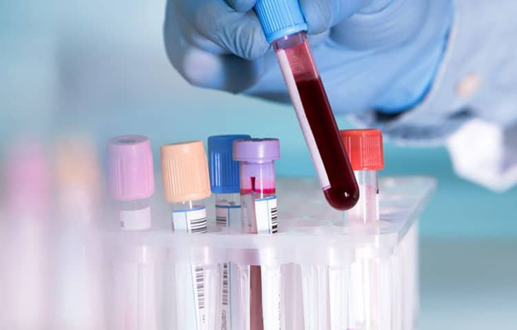 Xét nghiệm máu tổng quát là gì và các chỉ số xét nghiệm máu