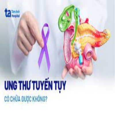 Bệnh ung thư tuyến tụy có chữa được không