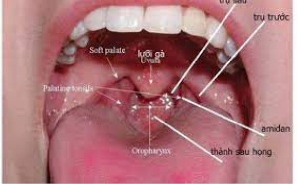 Hình ảnh ung thư vòm họng giai đoạn 1